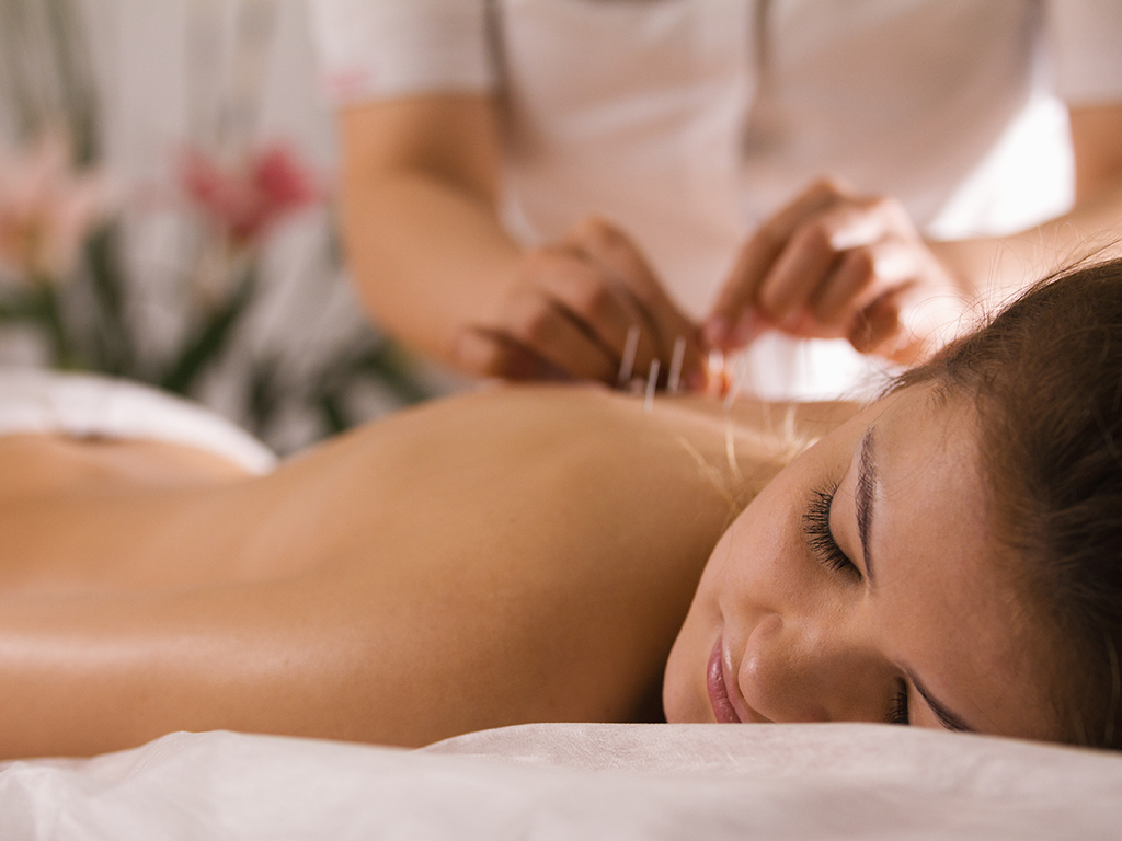 KMW Acupuncture