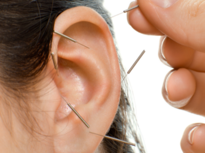 orlando-acupuncturist-www.kmw.care
